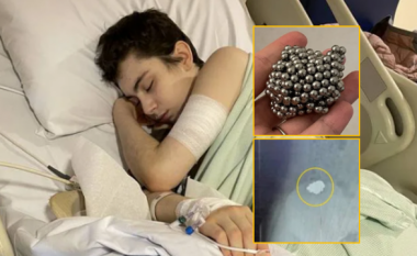 Djali 12-vjeçar nga Britania ha 54 magnetë për të parë nëse do të bëhet magnetik