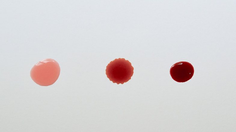 Nga infeksionet te kanceri: Çfarë e shkakton gjakderdhjen pas seksit?