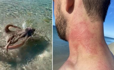 Ndodh edhe kjo, një burrë në Australi ‘rrahet’ nga një oktapod