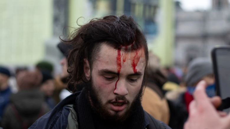 Studentët rusë paguajnë çmim të shtrenjtë për protestat politike