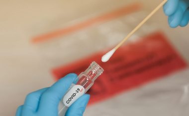 Qytetarët e Maqedonisë shpenzuan afër 20 milionë euro për testet PCR në shëndetësinë private