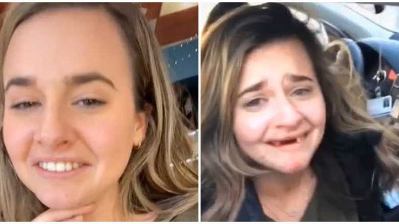 Pas një dite me alkool, 26-vjeçarja nga Delaware hipën mbi qafën e mikut – rrëzohet me fytyrë për tokë dhe mbetet pa disa dhëmbë