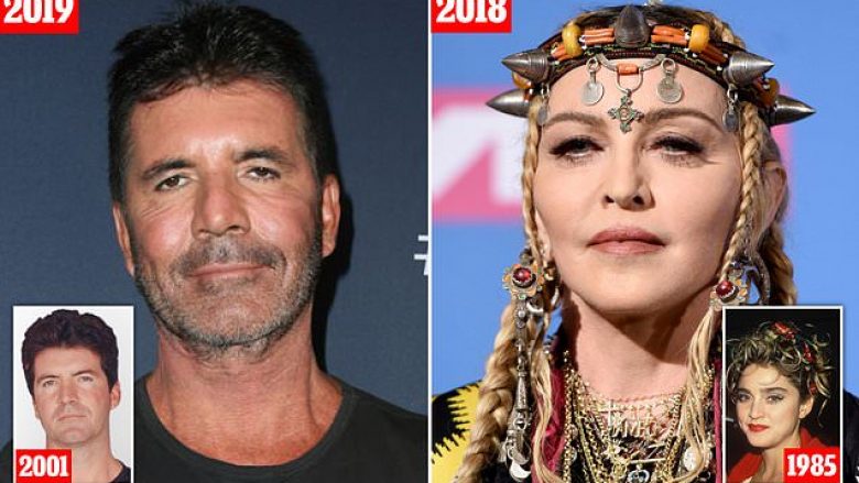 Botoksi i tepërt i ka lënë Simon Cowell dhe Madonnën me fytyrë të trishtuar dhe pamundësinë për të bërë mimika