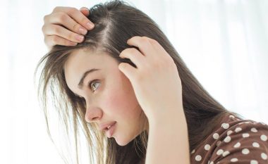Rënia e flokëve mund të parandalohet – Kjo është forma për t’u kujdesur sa më mirë për to!