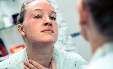 Këshilla e dermatologut: Perimet e gjelbra lehtësojnë inflamacionin dhe skuqjen në fytyrë