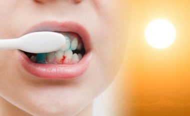 Gjakrrjedhja e mishit të dhëmbëve mund të tregojë mungesë të vitaminës C