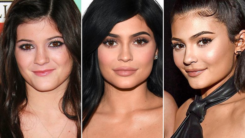 Kylie Jenner thotë se bëri ndërhyrje në buzë pasi një djalë e përqeshi për aftësitë e puthjes