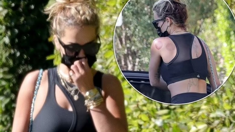 Rita Ora fotografohet duke shkuar në seancën e ‘pilates’, ndërsa shenjat në shpinën e saj tregojnë se ajo ka bërë hixhamën