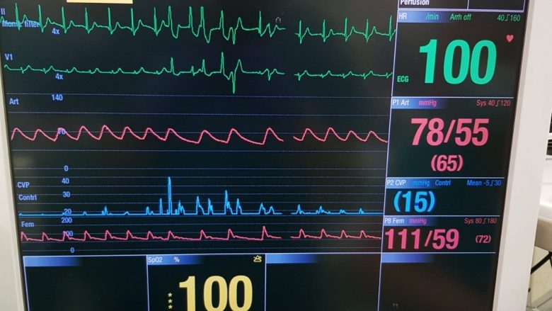 Realizohet edhe një transplantim i zemrës në Maqedoninë e Veriut