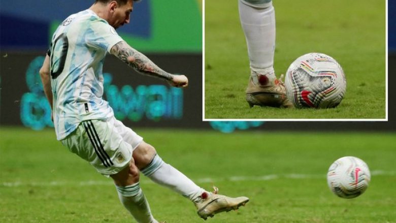 Messi përkundër se i gjakosur në këmbë, arriti të përfundonte ndeshje jetike për Argjentinën