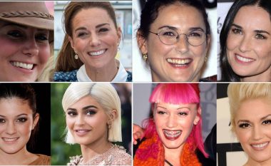 Nga Kylie Jenner te Kate Middleton: Shndërrimet më dramatike të dhëmbëve