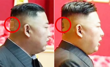 Nxiten spekulime për shëndetin e Kim Jong-un, është parë me një njollë të errët në kokën e tij