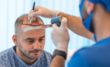 VatanMed – klinika e njohur botërore për mbjelljen e flokëve në qendër të Prishtinës  
