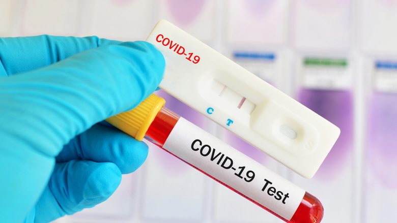 Falsifikuan teste negative të COVID-19 për mërgimtarët, arrestohen tre persona