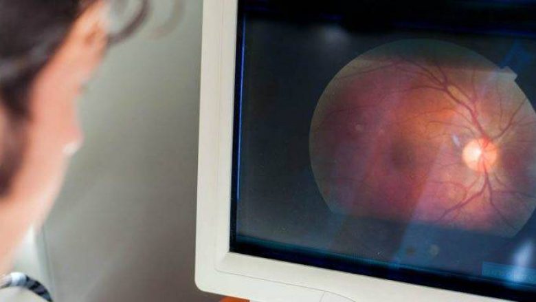 Infarkti i syve – si ndodh dhe si ta dallojmë atë?