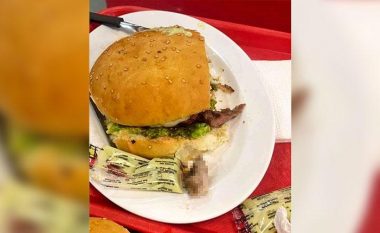 Një grua gjen gishtin e njeriut në hamburgerin që e kishte blerë, policia boliviane fillon hetimet  