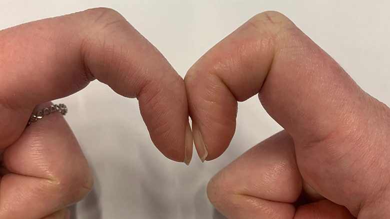 Testi në dy sekonda: Lidhni të dy gishtat tregues dhe zbuloni nëse jeni të kërcënuar nga një sëmundje të rrezikshme!