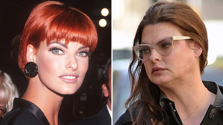 Supermodelja Linda Evangelista thotë se ka mbetur ‘e deformuar’ nga procedurat kozmetike!