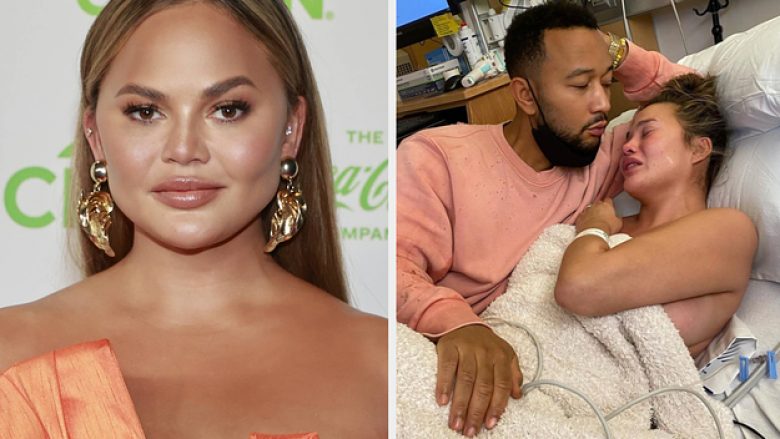 Një vit më parë humbi foshnjën pas një aborti spontan – Chrissy Teigen kujton momentin me një fotografi prekëse nga spitali