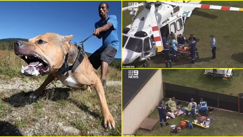 Ishte sa një ‘kalë i vogël’: Veterineri australian kërkon ndalimin e racave të qenve vrasës pasi dy gra u ‘copëtuan’ nga një pitbull gjigant