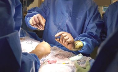 Mjekët amerikanë transplantuan një veshkë derri tek një pacient