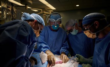 Kirurgët amerikanë testuan me sukses transplantin e veshkës së derrit te trupi i njeriut