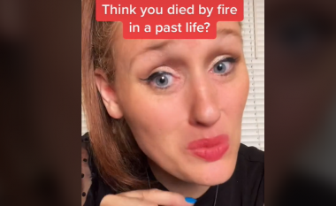 Parashikuesja në TikTok pretendon se ajo ‘ka vdekur nga zjarri’ në një jetë të kaluar, jep deklaratën shokuese pse njerëzit lindin me shenja të kuqe