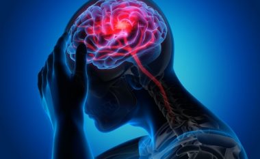 Katër faza të migrenës që bëjnë dallimin nga një dhimbje e zakonshme