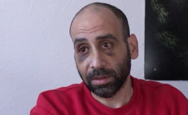 "Më goditi në fytyrë me këmbë, më është thyer hunda dhe kocka në fytyrë", emigranti sirian rrëfen se si u rrah nga ushtari bjellorus