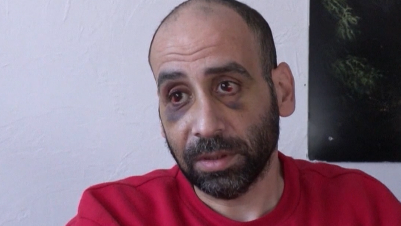 “Më goditi në fytyrë me këmbë, më është thyer hunda dhe kocka në fytyrë”, emigranti sirian rrëfen se si u rrah nga ushtari bjellorus