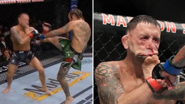 Një ndër nokautet më brutale në UFC, fytyra e Frankie Edgar u deformua plotësisht prej shqelmit të Marlon Veras