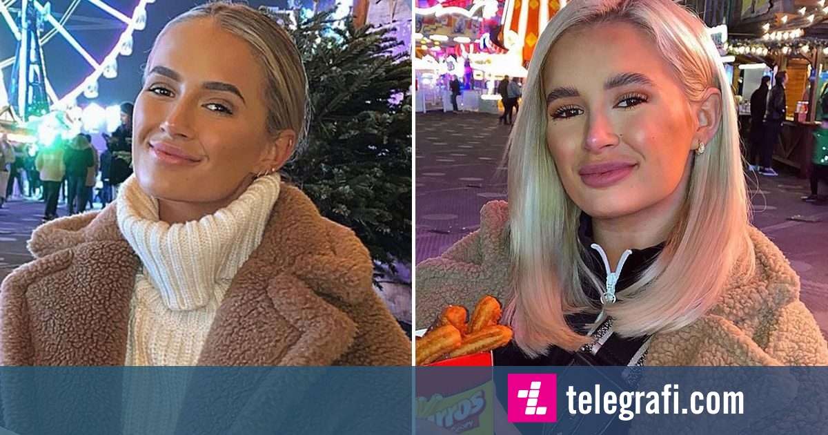 Molly Mae Hague Admits She Is Terrified Of Herself In Old Photos Before Removing Fillers 