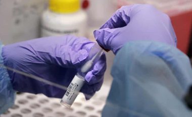 Studiuesit kanë zbuluar një lidhje midis Omicron dhe HIV, që paraqet një rrezik të lartë