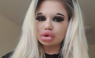 Gruaja që pretendon se ka “buzët më të mëdha në botë” po përgatitet për ndërhyrjen e 27-të, nuk shqetësohet se mund t’i “shpërthejnë” një ditë