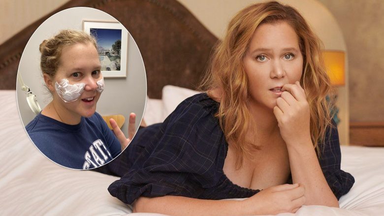 Amy Schumer largon mbushësit e faqeve: Doli që isha tashmë plot