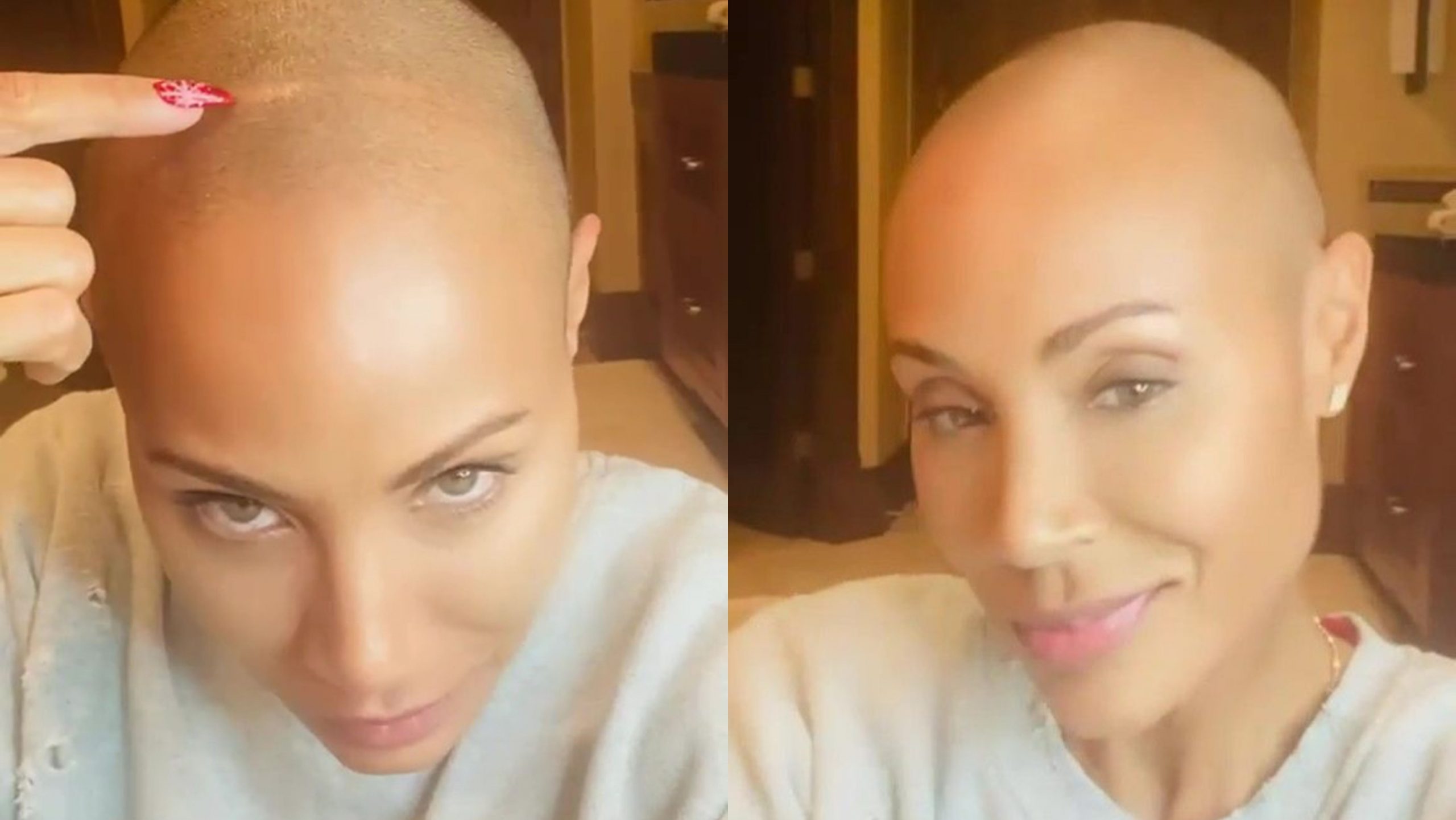 Jada Pinkett Smith ndan një përditësim për rënien e flokëve për shkak të alopecisë