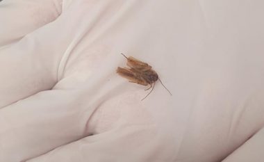 Burrit në Zelandë të Re i nxorën një insekt nga veshi pasi ndjeu “përpëlitje” për tri ditë