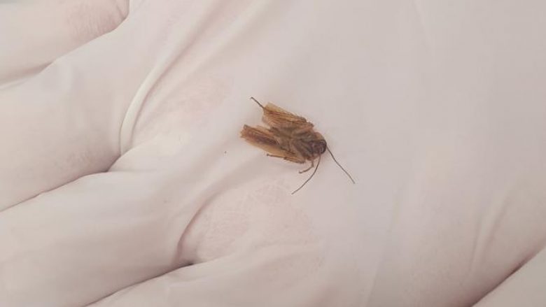 Burrit në Zelandë të Re i nxorën një insekt nga veshi pasi ndjeu “përpëlitje” për tri ditë