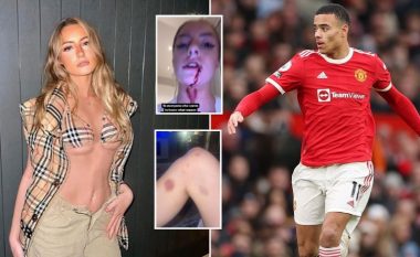 E dashura e Mason Greenwood e akuzon yllin e Man Utd për një sulm, publikon fotografi tronditëse në Instagram