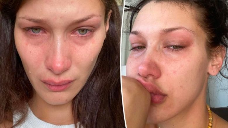 Bella Hadid flet sërish për betejën me shëndetin mendor dhe pse vendosi të ndajë këtë me fansat në Instagram