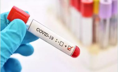 Maqedoni: Javën e kaluar pothuajse çdo i treti person i testuar ka qenë pozitiv për coronavirus