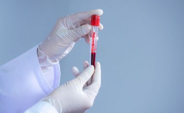 Është zbuluar një test i thjeshtë i gjakut që mund të tregojë rrezikun fatal të sulmit në zemër te pacientët në tre vitet e ardhshme
