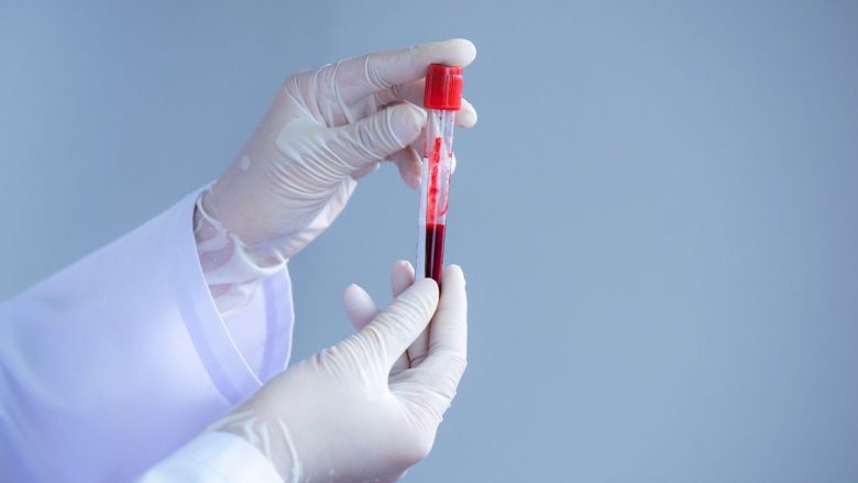 Është zbuluar një test i thjeshtë i gjakut që mund të tregojë rrezikun fatal të sulmit në zemër te pacientët në tre vitet e ardhshme