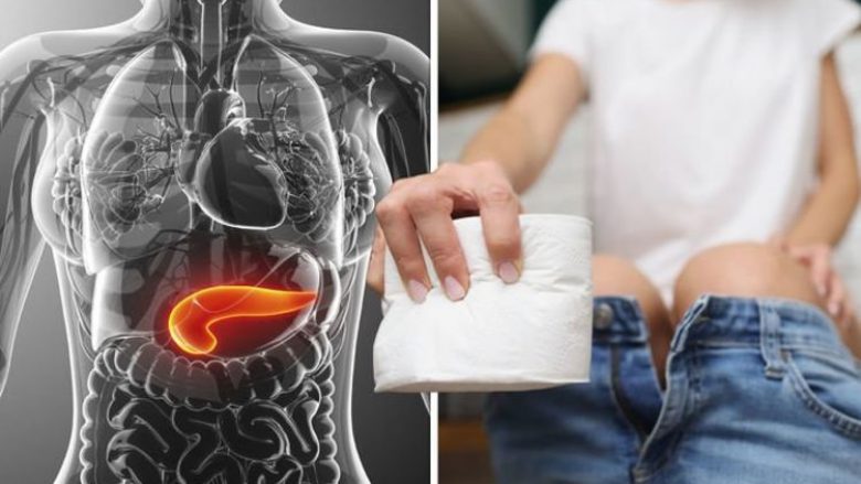 Simptoma e re e kancerit të pankreasit që mund të vërehet kur urinoni