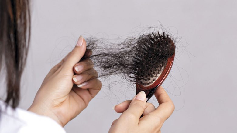 Një dermatolog shpjegoi pse flokët bien pas kalimit të coronavirusit