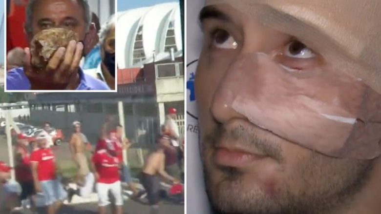 Lojtari i Gremios u dërgua me urgjencë në spital, pasi tifozët kundërshtarë sulmuan autobusin para derbit