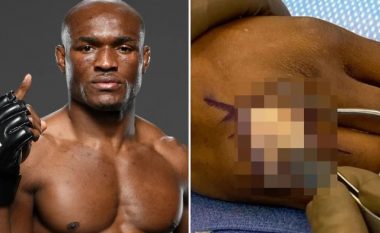 Dana White shqetëson fansat e UFC me një foto nga operacioni në dorë i kampionit Kamaru Usman