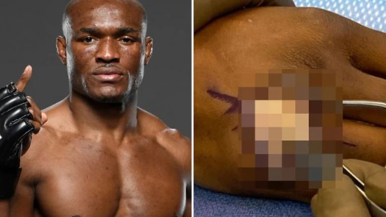 Dana White shqetëson fansat e UFC me një foto nga operacioni në dorë i kampionit Kamaru Usman