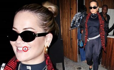 Rita Ora thekson dhëmbin e saj të artë gjatë një dalje në Los Angeles