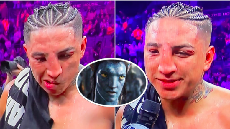 Mario Barrios mbeti me pamjen si të Avatarit, pas lëndimeve brutale që pësoi ndaj Keith Thurman